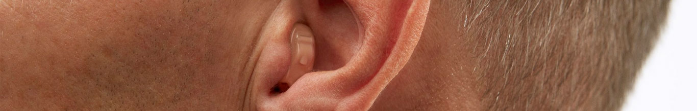 In The Ear (ITE) Hearing Aids Phonak, Resound, Siemens, Starkey, Oticon, Widex, Audio, Sonic